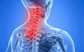 lower Neck pain