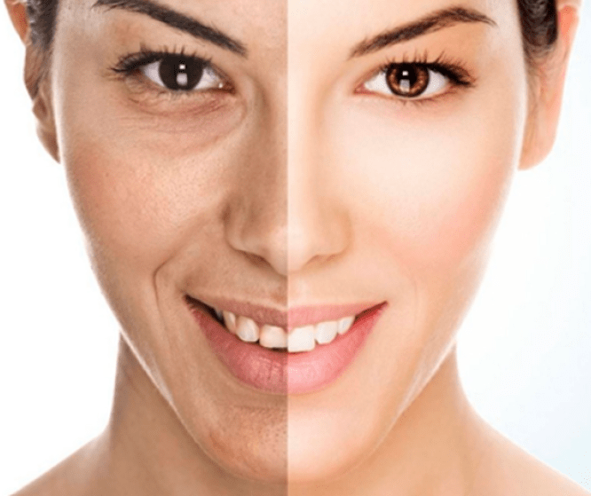 skin whitening treatment Ahmedabad