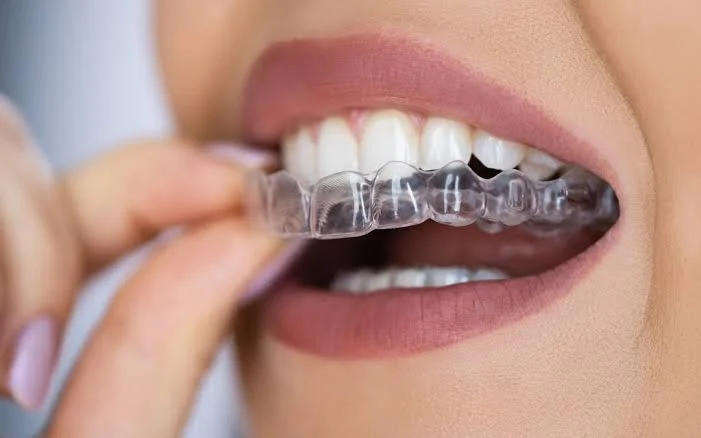 best orthodontist in Ahmedabad